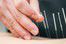 Acupuncteur